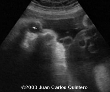 case1105-08