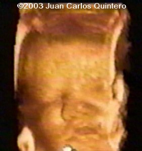 case1105-09