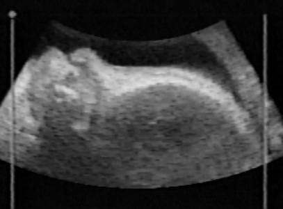 case1105-10