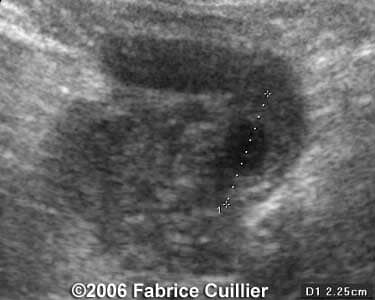 case12a