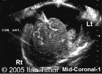 case154_1