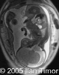 case154_19