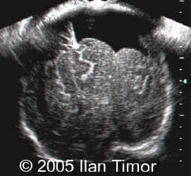 case154_7