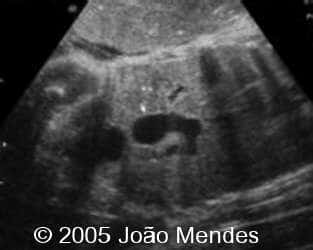 case155_1