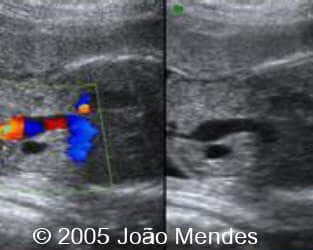 case155_10