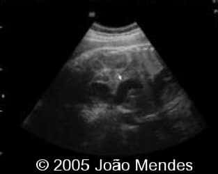 case155_6