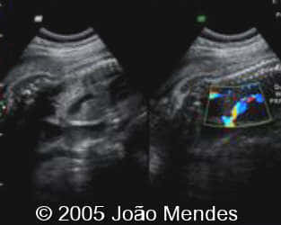 case155_9