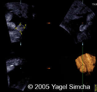 case156_14