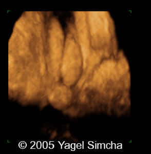 case156_15