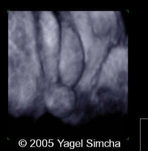 case156_16