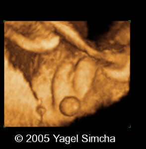 case156_17
