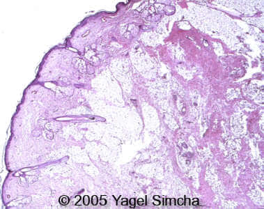 case156_19