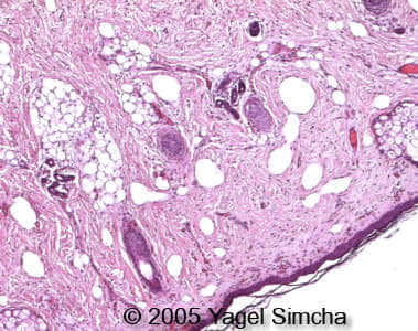 case156_20
