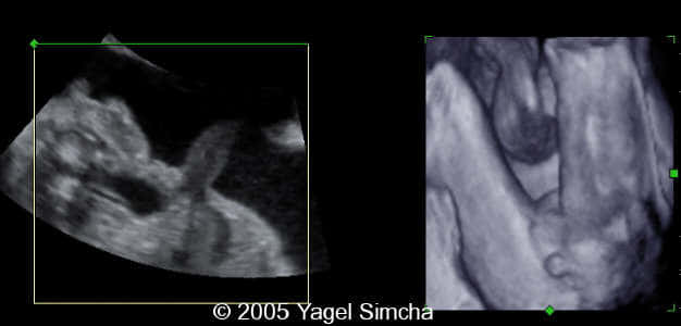 case156_6