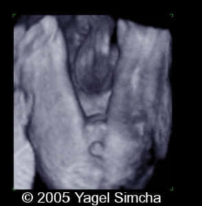 case156_7