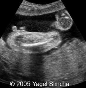 case156_8