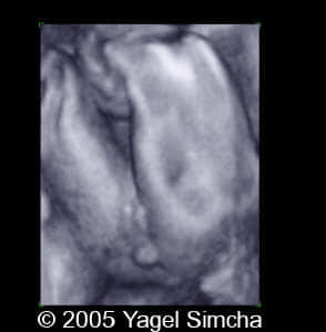 case156_9
