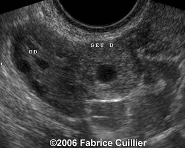 case16a
