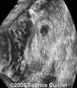 case1a