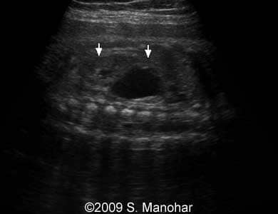 Case2-03
