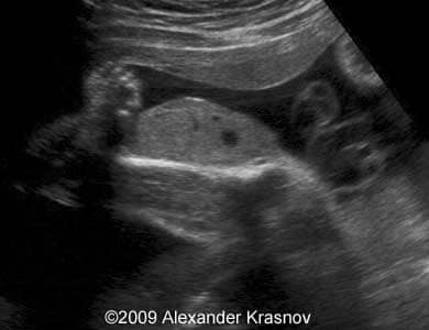 Case255_1