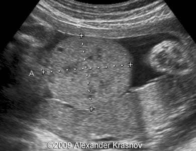 Case255_2