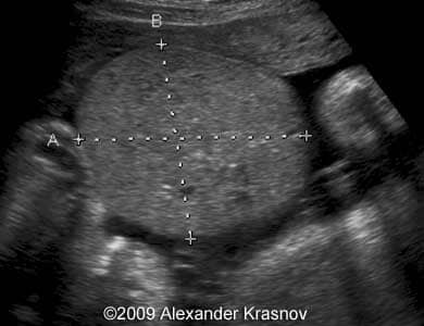 Case255_3