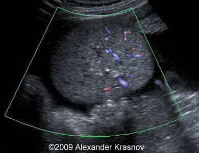 Case255_4