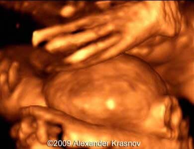 Case255_5