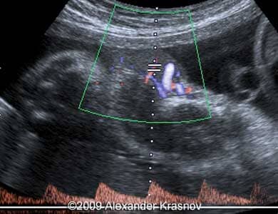 Case255_7