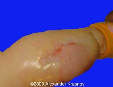 Case255_8