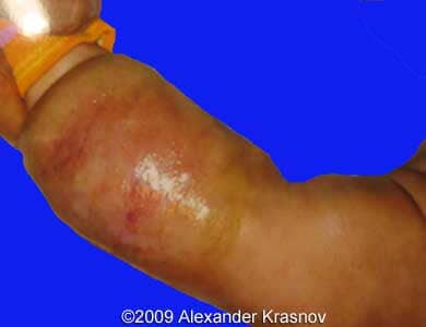 Case255_9