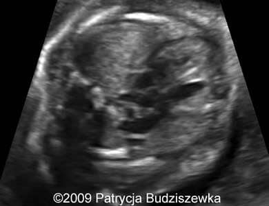 Case258_1