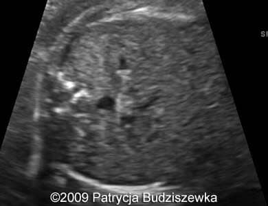 Case258_10