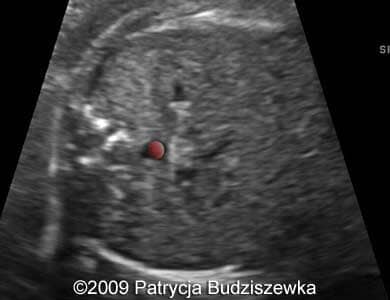 Case258_10b