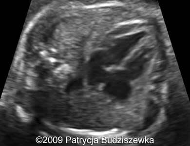Case258_12