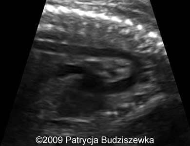 Case258_14