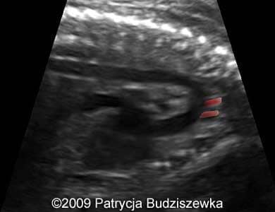 Case258_14b