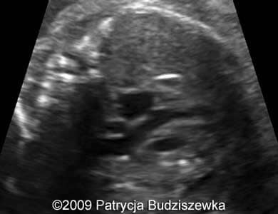 Case258_2