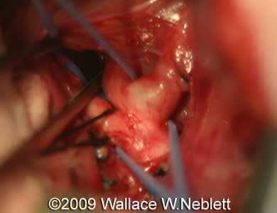 Case258_20