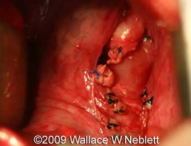 Case258_21