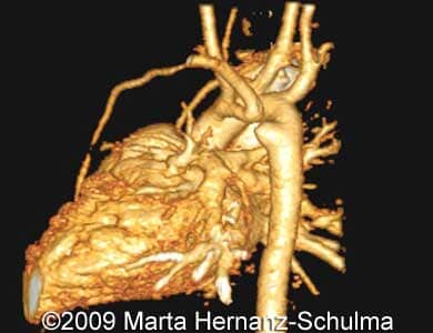 Case258_22