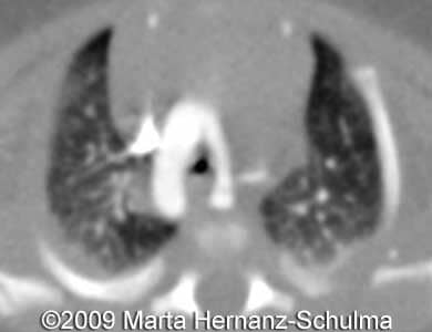 Case258_23