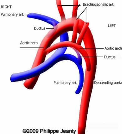 Case258_25