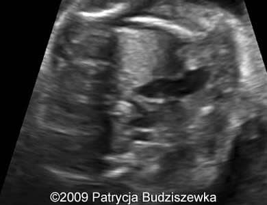 Case258_3