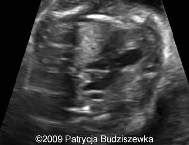 Case258_4