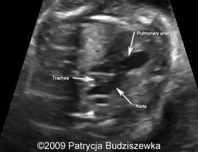 Case258_4a