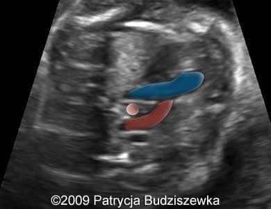 Case258_4b