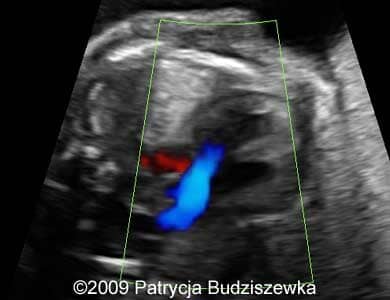 Case258_6