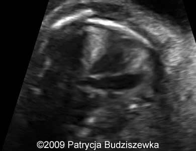 Case258_8